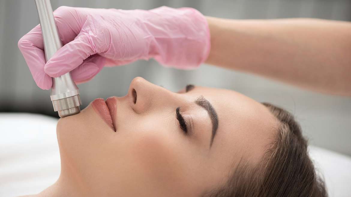 Microdermabrasion