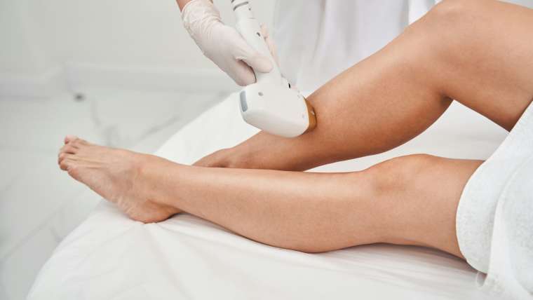 Laser Hair Removal
